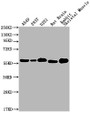 Western Blot; Positive WB detected in: A549 whole cell lysate, 293T whole cell lysate, U251 whole cell lysate, Rat Brain tissue, Rabbit Skeletal Muscle tissue; All lanes: PKM antibody at 1:1000; Secondary; Goat polyclonal to Mouse IgG at 1/10000 dilution; Predicted band size: 58 kDa; Observed band size: 58 KDa; Exposure time: 1min