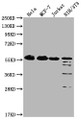 Western Blot; ,Positive WB detected in: Hela whole cell lysate, MCF-7 whole cell lysate, Jurkat whole cell lysate, NIH/3T3 whole cell lysate; ,All lanes: PKM antibody at 1:1000; ,Secondary; ,Goat polyclonal to Mouse IgG at 1/10000 dilution; ,Predicted band size: 58 kDa; ,Observed band size: 58 KDa; ,Exposure time: 1min