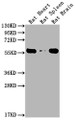 Western Blot; , Positive WB detected in: Rat Heart tissue, Rat Spleen tissue, Rat Brain tissue; , All lanes: PKM antibody at 1:4000; , Secondary; , Goat polyclonal to Mouse IgG at 1/10000 dilution; , Predicted band size: 55-60 kDa; , Observed band size: 55-60 kDa;