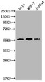 Western Blot; Positive WB detected in: Hela whole cell lysate, MCF-7 whole cell lysate, Jurkat whole cell lysate; All lanes: PKM antibody at 1:1000; Secondary; Goat polyclonal to Mouse IgG at 1/10000 dilution; Predicted band size: 58 kDa; Observed band size: 58 KDa; Exposure time: 1min