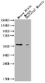 Western Blot; ,Positive WB detected in: Mouse Brain tissue, Mouse Skeldtal Muscle tissue; ,All lanes: PKM antibody at 1:1000; ,Secondary; ,Goat polyclonal to Mouse IgG at 1/10000 dilution; ,Predicted band size: 58 kDa; ,Observed band size: 58 KDa; ,Exposure time: 5min