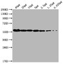 Western Blot; , Positive WB detected in: MCF-7 whole cell lysate at 40µg, 20µg, 10µg, 5µg, 2.5µg, 1.25µg, 0.625µg; , All lanes: PKM antibody at 1:1000; , Secondary; , Goat polyclonal to Mouse IgG at 1/10000 dilution; , Predicted band size: 58 kDa; , Observed band size: 58 KDa; , Exposure time: 5min