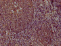 IHC image diluted at 1:100 and staining in paraffin-embedded human tonsil tissue performed on a Leica BondTM system. After dewaxing and hydration, antigen retrieval was mediated by high pressure in a citrate buffer (pH 6.0). Section was blocked with 10% normal goat serum 30min at RT. Then primary antibody (1% BSA) was incubated at 4°C overnight. The primary is detected by a biotinylated secondary antibody and visualized using an HRP conjugated SP system.,