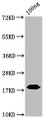 Western Blot; Positive WB detected in: SARS-CoV-2 nucleocapsid recombinant protein from E. Coli at 100ng; All lanes N antibody at 1:2000; Secondary; Goat polyclonal to mouse IgG at 1/50000 dilution; Predicted band size: 18 KDa; Observed band size: 18 KDa;