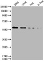 Western Blot; ,Positive WB detected in: HIS fusion protein 2 at 20ng, 10ng, 5ng, 2.5ng; ,All lanes: HIS antibody at 1:1000; ,Secondary; ,Goat polyclonal to mouse IgG at 1/50000 dilution; ,Predicted band size: 60 kDa; ,Observed band size: 60 kDa;