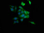 Immunofluorescence staining of HepG2 cells with CAC10351 at 1:133, counter-stained with DAPI. The cells were fixed in 4% formaldehyde, permeabilized using 0.2% Triton X-100 and blocked in 10% normal Goat Serum. The cells were then incubated with the antibody overnight at 4°C. The secondary antibody was Alexa Fluor 488-congugated AffiniPure Goat Anti-Rabbit IgG(H+L).
