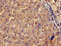 Immunohistochemistry of paraffin-embedded human liver tissue using CAC10359 at dilution of 1:100
