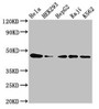 Western Blot; Positive WB detected in: Hela whole cell lysate, HEK293 whole cell lysate, HepG2 whole cell lysate, Raji whole cell lysate, K562 whole cell lysate; All lanes: CSNK2A1 antibody at 3µg/ml; Secondary; Goat polyclonal to rabbit IgG at 1/50000 dilution; Predicted band size: 46, 30 kDa; Observed band size: 46 kDa