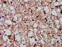 IHC image diluted at 1:300 and staining in paraffin-embedded human brain tissue performed on a Leica BondTM system. After dewaxing and hydration, antigen retrieval was mediated by high pressure in a citrate buffer (pH 6.0). Section was blocked with 10% normal goat serum 30min at RT. Then primary antibody (1% BSA) was incubated at 4°C overnight. The primary is detected by a biotinylated secondary antibody and visualized using an HRP conjugated SP system.