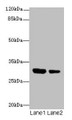 Western blot; All lanes: IL1A antibody at 6µg/ml; Lane 1: Jurkat whole cell lysate; Lane 2: Human placenta tissue; Secondary; Goat polyclonal to rabbit IgG at 1/10000 dilution; Predicted band size: 31 kDa; Observed band size: 31 kDa