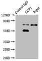 Immunoprecipitating LCP1 in Jurkat whole cell lysate; , Lane 1: Rabbit control IgG instead in Jurkat whole cell lysate. For western blotting, a HRP-conjugated Protein G antibody was used as the secondary antibody (1/2000); , Lane 2: CAC10375 (8µg) + Jurkat whole cell lysate (500µg); , Lane 3: Jurkat whole cell lysate (20µg)