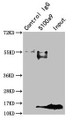 Immunoprecipitating S100a9 in Mouse spleen tissue; ,Lane 1: Rabbit control IgG instead in Mouse spleen tissue. For western blotting, a HRP-conjugated Protein G antibody was used as the secondary antibody (1/2000); ,Lane 2: CAC10381 (8µg) + Mouse spleen tissue (500µg); ,Lane 3: Mouse spleen tissue (10µg)