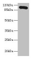 Western blot; All lanes: Thbs3 antibody at 16µg/ml + HepG2 whole cell lysate; Secondary; Goat polyclonal to rabbit IgG at 1/10000 dilution; Predicted band size: 105 kDa; Observed band size: 105 kDa