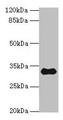 Western blot; All lanes: TMEM53 antibody at 5µg/ml + Mouse brain tissue; Secondary; Goat polyclonal to rabbit IgG at 1/10000 dilution; Predicted band size: 32, 24 kDa; Observed band size: 32 kDa