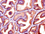 IHC image of CAC10395 diluted at 1:600 and staining in paraffin-embedded human prostate tissue performed on a Leica BondTM system. After dewaxing and hydration, antigen retrieval was mediated by high pressure in a citrate buffer (pH 6.0). Section was blocked with 10% normal goat serum 30min at RT. Then primary antibody (1% BSA) was incubated at 4°C overnight. The primary is detected by a biotinylated secondary antibody and visualized using an HRP conjugated SP system.