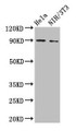 Western Blot; Positive WB detected in: Hela whole cell lysate, NIH/3T3 whole cell lysate; All lanes: L1CAM antibody at 2µg/ml; Secondary; Goat polyclonal to rabbit IgG at 1/50000 dilution; Predicted band size: 141, 140, 139 kDa; Observed band size: 90 kDa