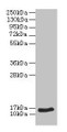 Western blot; All lanes: NPPB antibody at 2µg/ml + Hela whole cell lysate; Secondary; Goat polyclonal to rabbit IgG at 1/10000 dilution; Predicted band size: 15 kDa; Observed band size: 15 kDa