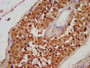 IHC image of CAC10417 diluted at 1:100 and staining in paraffin-embedded human testis tissue performed on a Leica BondTM system. After dewaxing and hydration, antigen retrieval was mediated by high pressure in a citrate buffer (pH 6.0). Section was blocked with 10% normal goat serum 30min at RT. Then primary antibody (1% BSA) was incubated at 4°C overnight. The primary is detected by a biotinylated secondary antibody and visualized using an HRP conjugated SP system.