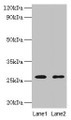 Western blot; All lanes: ADIPOQ antibody at 2µg/ml; Lane 1: NIH/3T3 whole cell lysate; Lane 2: HL60 whole cell lysate; Secondary; Goat polyclonal to rabbit IgG at 1/10000 dilution; Predicted band size: 27 kDa; Observed band size: 27 kDa