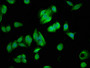 Immunofluorescence staining of HepG2 cells with CAC10454 at 1:166, counter-stained with DAPI. The cells were fixed in 4% formaldehyde, permeabilized using 0.2% Triton X-100 and blocked in 10% normal Goat Serum. The cells were then incubated with the antibody overnight at 4°C. The secondary antibody was Alexa Fluor 488-congugated AffiniPure Goat Anti-Rabbit IgG(H+L).