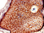 Immunohistochemistry of paraffin-embedded human skin tissue using CAC10462 at dilution of 1:100