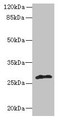Western blot; All lanes: fabI antibody at 5µg/ml + Mouse heart tissue; Secondary; Goat polyclonal to rabbit IgG at 1/10000 dilution; Predicted band size: 28 kDa; Observed band size: 28 kDa