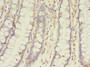 Immunohistochemistry of paraffin-embedded human colon tissue using CAC10470 at dilution of 1:100