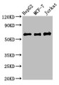 Western Blot; Positive WB detected in: HepG2 whole cell lysate, MCF-7 whole cell lysate, Jurkat whole cell lysate; All lanes: PRUNE1 antibody at 4µg/ml; Secondary; Goat polyclonal to rabbit IgG at 1/50000 dilution; Predicted band size: 51, 43, 31, 27, 25, 19 kDa; Observed band size: 60 kDa