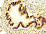 IHC image diluted at 1:300 and staining in paraffin-embedded human lung tissue performed on a Leica BondTM system. After dewaxing and hydration, antigen retrieval was mediated by high pressure in a citrate buffer (pH 6.0). Section was blocked with 10% normal goat serum 30min at RT. Then primary antibody (1% BSA) was incubated at 4°C overnight. The primary is detected by a biotinylated secondary antibody and visualized using an HRP conjugated SP system.