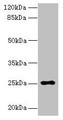 Western blot; All lanes: ARPIN antibody at 0.5µg/ml + HepG2 whole cell lysate; Secondary; Goat polyclonal to rabbit IgG at 1/10000 dilution; Predicted band size: 25, 44 kDa; Observed band size: 25 kDa
