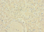 Immunohistochemistry of paraffin-embedded human liver tissue using CAC10484 at dilution of 1:100