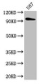 Western Blot; Positive WB detected in: U87 whole cell lysate; All lanes: TTLL6 antibody at 5µg/ml; Secondary; Goat polyclonal to rabbit IgG at 1/50000 dilution; Predicted band size: 97, 65 kDa; Observed band size: 97 kDa