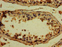 IHC image diluted at 1:500 and staining in paraffin-embedded human testis tissue performed on a Leica BondTM system. After dewaxing and hydration, antigen retrieval was mediated by high pressure in a citrate buffer (pH 6.0). Section was blocked with 10% normal goat serum 30min at RT. Then primary antibody (1% BSA) was incubated at 4°C overnight. The primary is detected by a biotinylated secondary antibody and visualized using an HRP conjugated SP system.