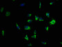 Immunofluorescence staining of SH-SY5Y cells with CAC10489 at 1:133, counter-stained with DAPI. The cells were fixed in 4% formaldehyde, permeabilized using 0.2% Triton X-100 and blocked in 10% normal Goat Serum. The cells were then incubated with the antibody overnight at 4°C. The secondary antibody was Alexa Fluor 488-congugated AffiniPure Goat Anti-Rabbit IgG(H+L).