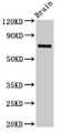 Western Blot; , Positive WB detected in: Rat brain tissue; , All lanes: L3MBTL4 antibody at 3µg/ml; , Secondary; , Goat polyclonal to rabbit IgG at 1/50000 dilution; , Predicted band size: 72, 62 kDa; , Observed band size: 72 kDa