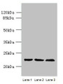 Western blot; All lanes: WDYHV1 antibody at 6µg/ml; Lane 1: Mouse heart tissue; Lane 2: MCF-7 whole cell lysate; Lane 3: U251 whole cell lysate; Secondary; Goat polyclonal to Rabbit IgG at 1/10000 dilution; Predicted band size: 24, 17 kDa; Observed band size: 24 kDa;