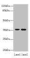 Western blot; All lanes: EEF2KMT antibody at 6µg/ml; Lane 1: Hela whole cell lysate; Lane 2: 293T whole cell lysate; Secondary; Goat polyclonal to rabbit IgG at 1/10000 dilution; Predicted band size: 37, 34 kDa; Observed band size: 37 kDa