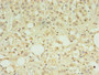Immunohistochemistry of paraffin-embedded human adrenal gland tissue using CAC10519 at dilution of 1:100