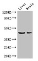 Western Blot; Positive WB detected in: Mouse liver tissue, Mouse brain tissue; All lanes: METTL2A antibody at 3µg/ml; Secondary; Goat polyclonal to rabbit IgG at 1/50000 dilution; Predicted band size: 44, 28 kDa; Observed band size: 44 kDa;
