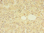 Immunohistochemistry of paraffin-embedded human adrenal gland tissue using CAC10527 at dilution of 1:100