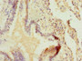 Immunohistochemistry of paraffin-embedded human lung tissue using CAC10528 at dilution of 1:100