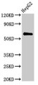 Western Blot; ,Positive WB detected in: HepG2 whole cell lysate; ,All lanes: CTPS2 antibody at 2.8µg/ml; ,Secondary; ,Goat polyclonal to rabbit IgG at 1/50000 dilution; ,Predicted band size: 66 kDa; ,Observed band size: 66 kDa