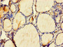 Immunohistochemistry of paraffin-embedded human thyroid tissue using CAC10531 at dilution of 1:100