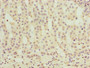 Immunohistochemistry of paraffin-embedded human adrenal gland tissue using CAC10539 at dilution of 1:100