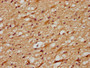 IHC image diluted at 1:700 and staining in paraffin-embedded human brain tissue performed on a Leica BondTM system. After dewaxing and hydration, antigen retrieval was mediated by high pressure in a citrate buffer (pH 6.0). Section was blocked with 10% normal goat serum 30min at RT. Then primary antibody (1% BSA) was incubated at 4°C overnight. The primary is detected by a biotinylated secondary antibody and visualized using an HRP conjugated SP system.