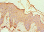 Immunohistochemistry of paraffin-embedded human skin tissue using CAC10558 at dilution of 1:100