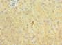 Immunohistochemistry of paraffin-embedded human liver tissue using CAC10561 at dilution of 1:100