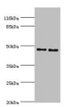 Western blot; All lanes: Serpin H1 antibody at 2µg/ml; Lane 1: NIH/3T3 whole cell lysate; Lane 2: A2780 whole cell lysate; Secondary; Goat polyclonal to rabbit IgG at 1/10000 dilution; Predicted band size: 46 kDa; Observed band size: 46 kDa;