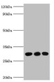 Western blot; All lanes: CA1 antibody at 6µg/ml; Lane 1: Jurkat whole cell lysate; Lane 2: K562 whole cell lysate; Lane 3: Mouse spleen tissue; Secondary; Goat polyclonal to rabbit IgGat 1/10000 dilution; Predicted band size: 29 kDa; Observed band size: 29 kDa