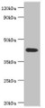 Western blot; All lanes: Acid ceramidase antibody at 6µg/ml + Mouse heart tissue; Secondary; Goat polyclonal to rabbit IgG at 1/10000 dilution; Predicted band size: 45, 47 kDa; Observed band size: 45 kDa;